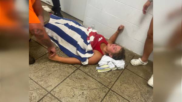 Teen says she was struck by lightning while on lifeguard duty