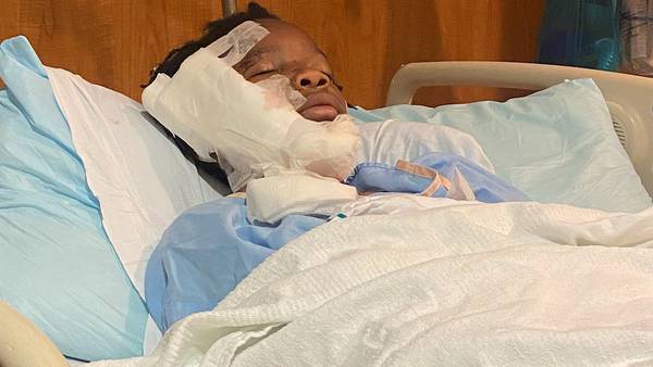 ‘He fought him off’: Charlotte 10-year-old recovering after dog attack