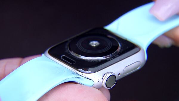 Another local person claims Apple Watch caused arm reaction