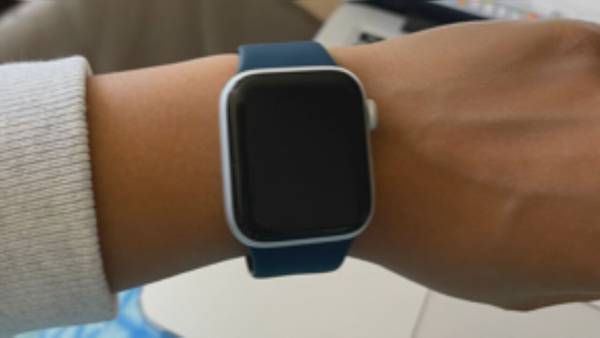 Some say Apple Watch irritated skin, company will not refund their money
