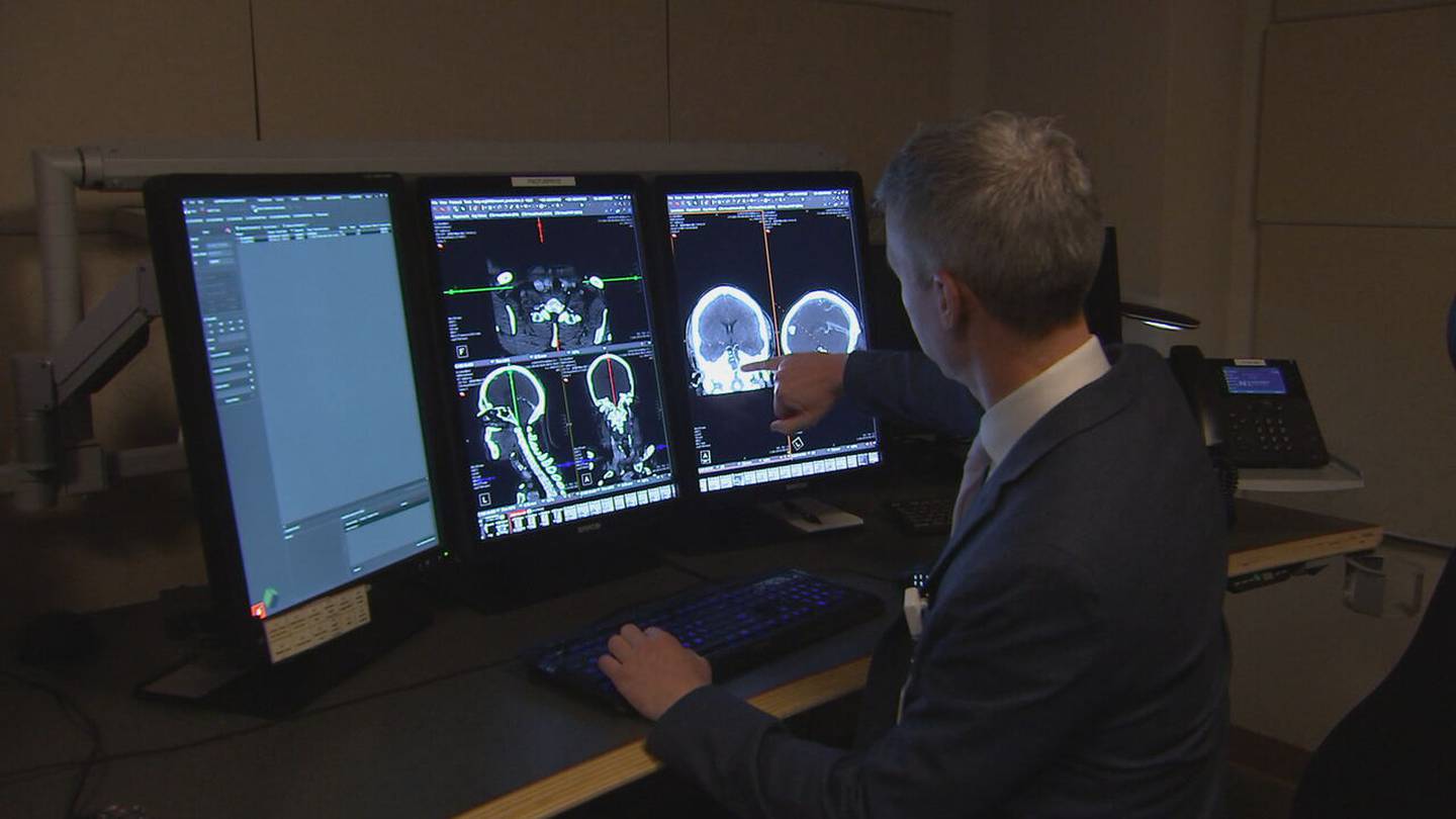 New AI technology helps treat stroke victims – WSOC TV